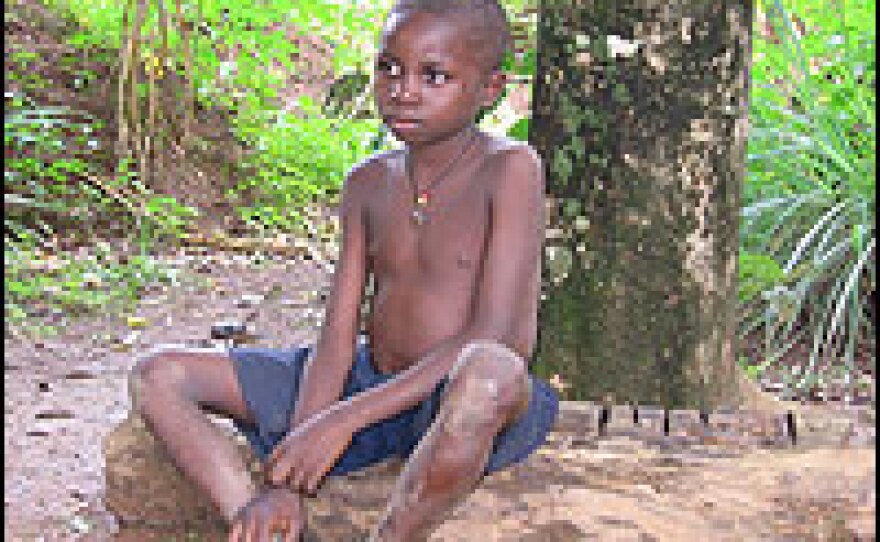 Chidi Elom, age 8, sat at this spot for three months last year as he waited for a guinea worm to make its way out of his body. He couldn't go to school or help his family, because the eruption makes it too painful to stand or walk. Children and adults can have multiple guinea worm infections at any given time.