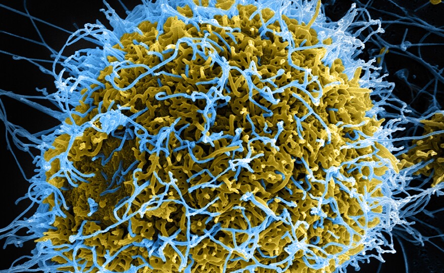 Stringy particles of Ebola virus (blue) bud from a chronically infected cell (yellow-green) in this colorized, scanning electron micrograph.