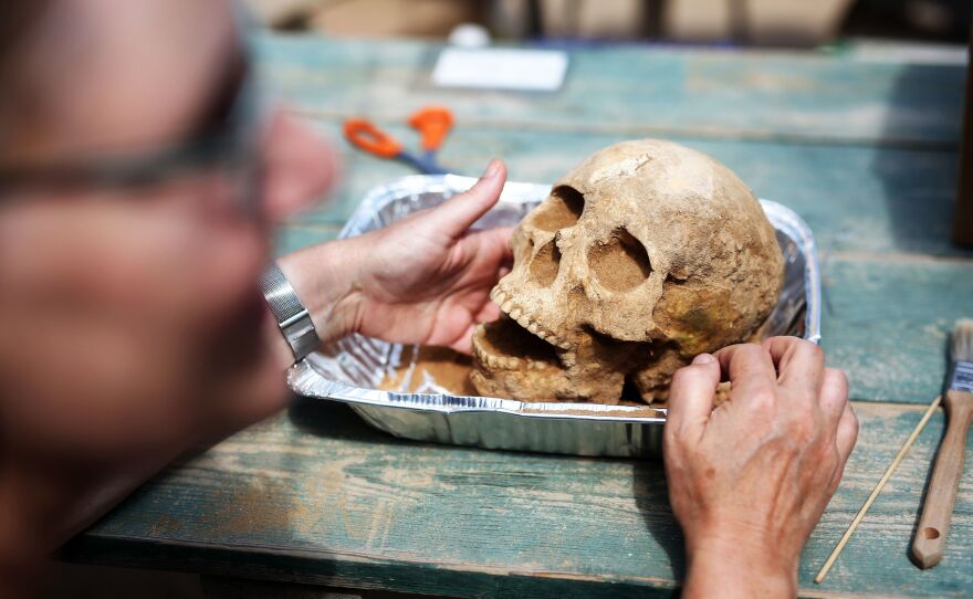 Anthropologist Sherry Fox displays a skull discovered at the Ashkelon excavation site, on June 28.