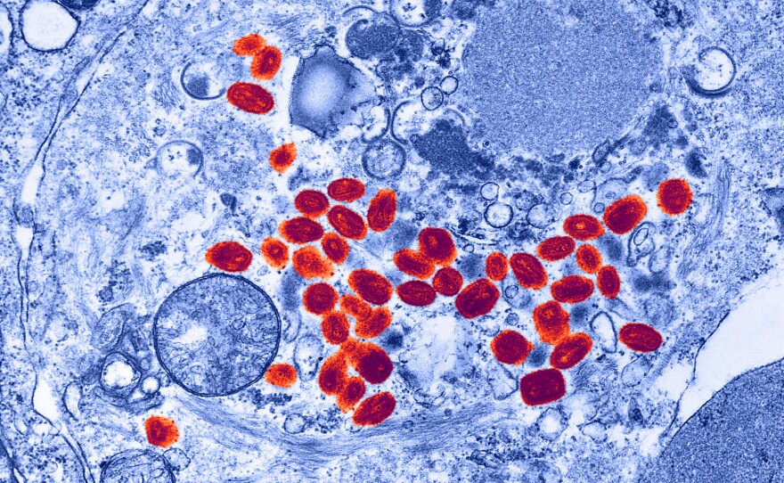 Not something you'd want to find: smallpox viruses infect a cell.