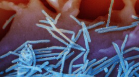 An electron microscope image provided by the National Institutes of Health shows human respiratory syncytial virus virions, colorized blue, and antibodies against an RSV protein, colorized yellow.