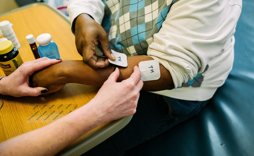 As part of his occupational therapy session, Troy Hodge gets little jolts of electricity through patches on his left arm. The stimulation is thought to help rekindle communication between the brain and nerves and muscles that were affected by his stroke.