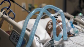 In this Nov. 19, 2020, file photo, ventilator tubes are attached to a COVID-19 patient at Providence Holy Cross Medical Center in the Mission Hills section of Los Angeles. 