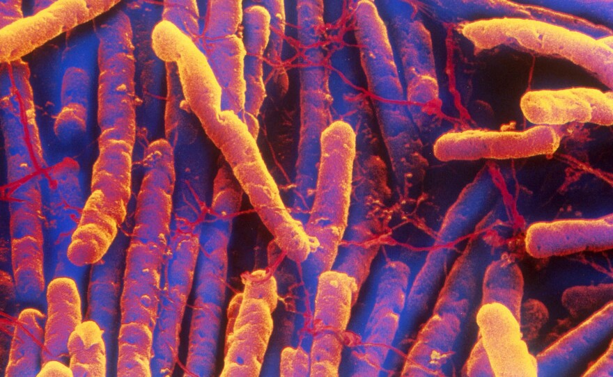 C. diff infections, which rose for decades, are now falling, according to the CDC.