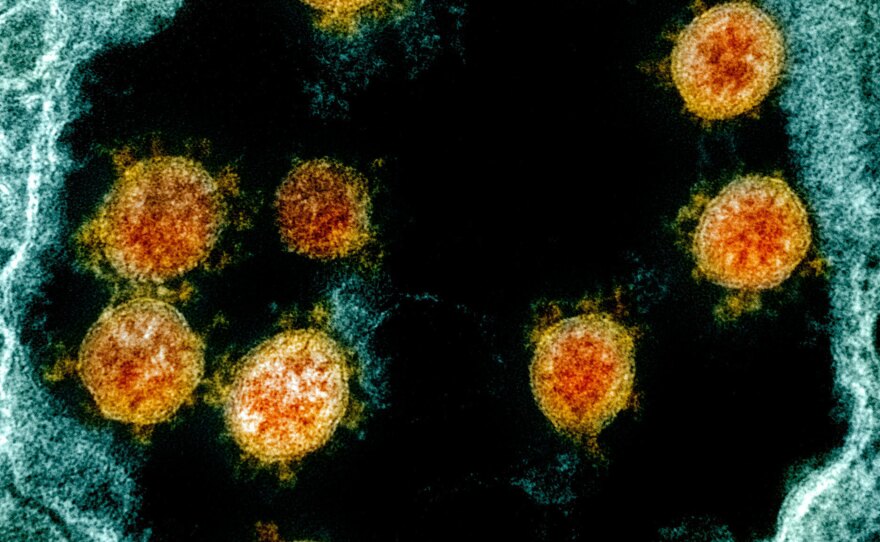 Internationally, scientists now have on file the genomes of more than 47,000 different samples of the virus that causes COVID-19 — up from just one in January. Here's a transmission electron micrograph of SARS-CoV-2 virus particles (orange) isolated from a patient.
