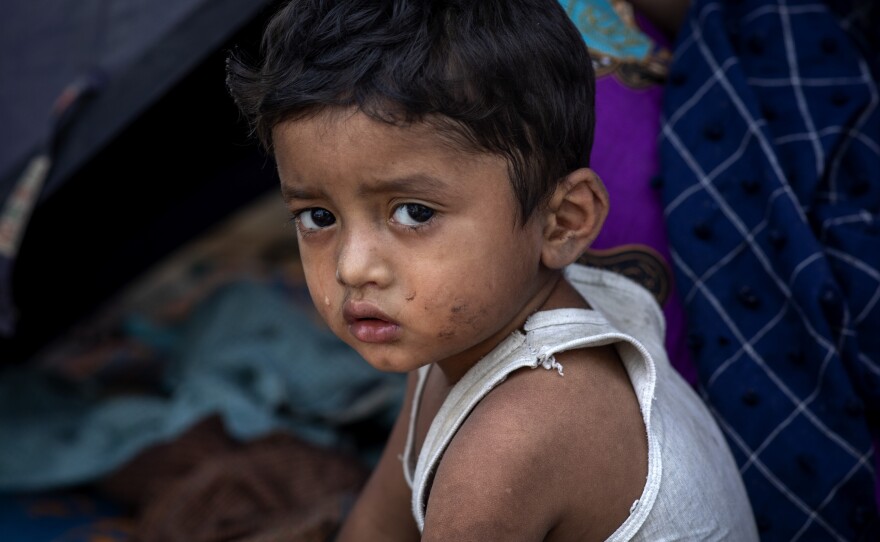 A Rohingya refugee boy shown after a massive fire broke out in March, destroying thousands of shelters and killing at least 15 people at Balukhali refugee camp in Cox's Bazar, Bangladesh.