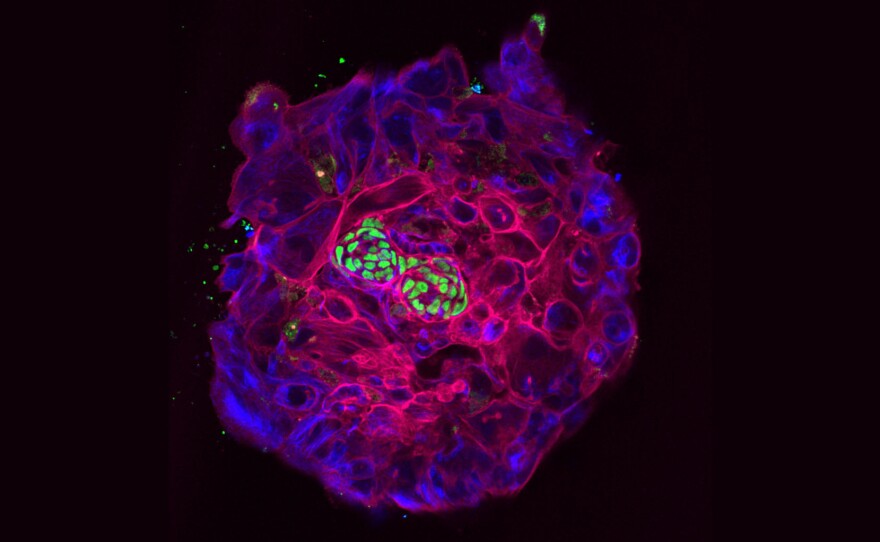 A human embryo kept alive in the lab for 12 days begins to show signs of early development. The green cells seen here in the center would go on to form the body. This embryo is in the process of twinning, forming two small spheres out of one.