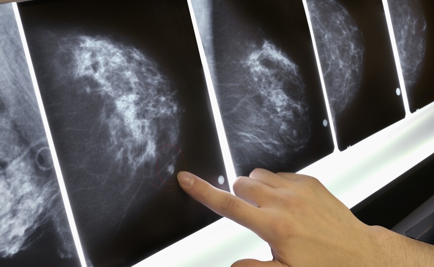 The out-of-pocket expense of mammograms, MRIs and other tests and treatments can be several thousand dollars each year when you have a high-deductible health policy.