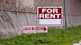 For rent signs in yard