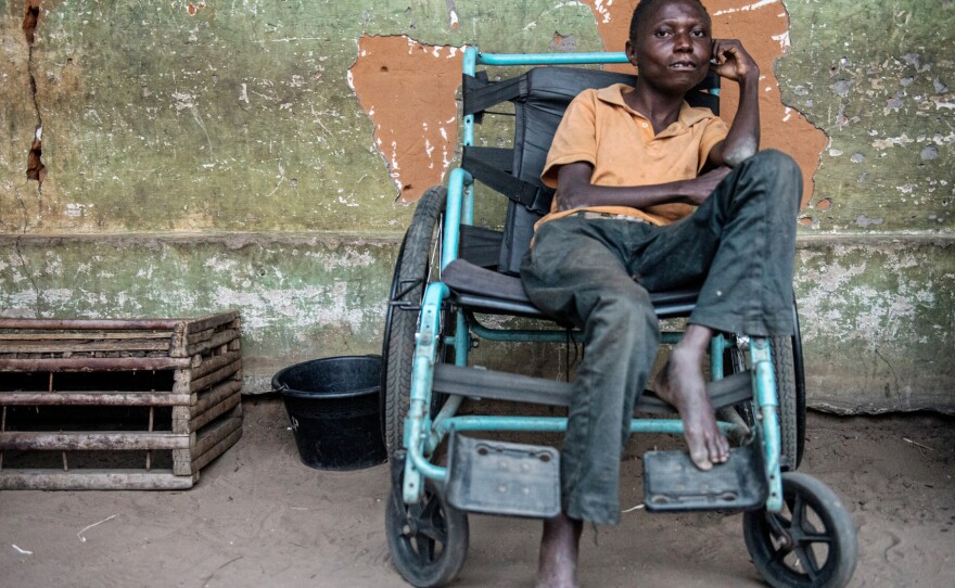 Etienne Tshiluanjim has konzo and survives on the brink of starvation. He and his family survive on the only food their neighbors donate to them — bitter cassava.