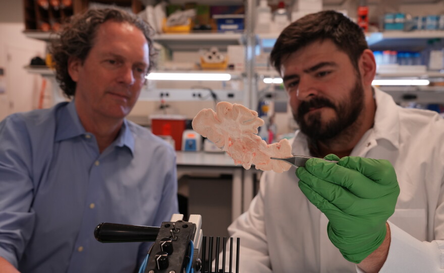 Allen Institute scientist Aaron Garcia (right) and executive vice president Ed Lein (left) examine a section of human brain in the lab. The institute has launched the Brain Health accelerator, which will focus on using genetic therapy to develop treatments for a range of brain disorders.