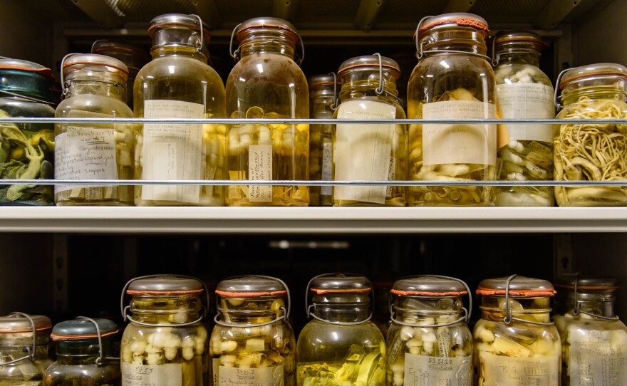The Smithsonian's collection holds as many as 30 to 40 million parasites, including millions of worms.