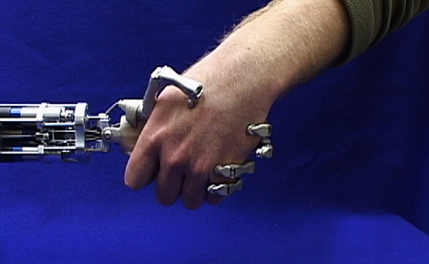 Prosthetic handshake
