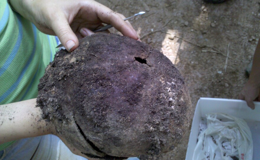 Skull with possible bullet wound.