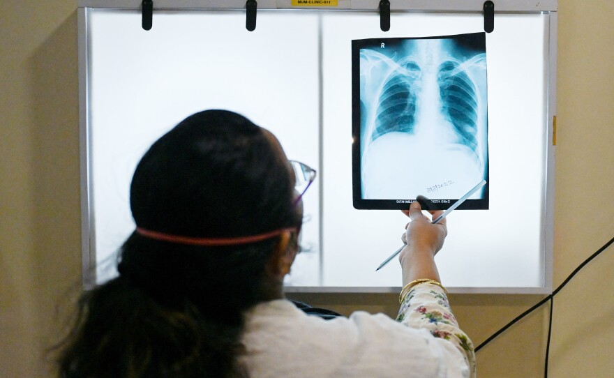 A doctor checks chest x-rays of a tuberculosis patient at a clinic in Mumbai, India, that treats those with drug-resistant strains of the disease. The World Health Organization has called for the eradication of this ancient and deadly infectious disease.