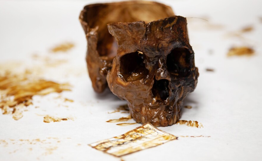 The team measures and documents bones of the body as part of intake OPID 699, which was one of 16 human remains exhumed at Sacred Heart Cemetery in Brooks County in January. Operation Identification's goal is to identify and repatriate unidentified human remains that were found in the South Texas borderlands.