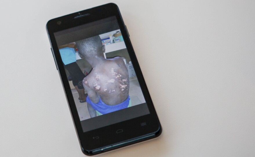 Issa Kouyate rescued this 6-year-old boy from his captors in Senegal and cared for him in his own house.