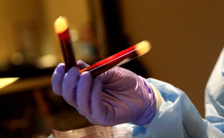 A new study that analyzed blood donations from December 2019 to early January helped show that the coronavirus infected people in the U.S. earlier than previously thought.