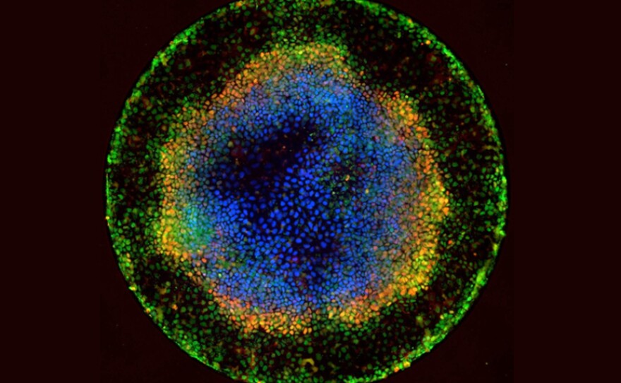 Embryoids like this one are created from stem cells and resemble very primitive human embryos. Scientist hope to use them to learn more about basic human biology and development.