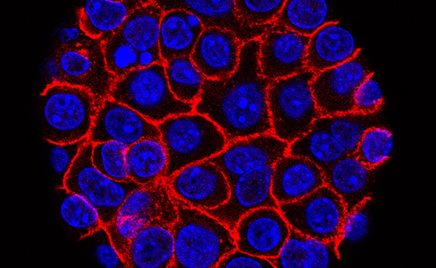 This undated microscope image from USC via the NIH shows pancreatic cancer cells, nuclei in blue, growing as a sphere encased in membranes, red.