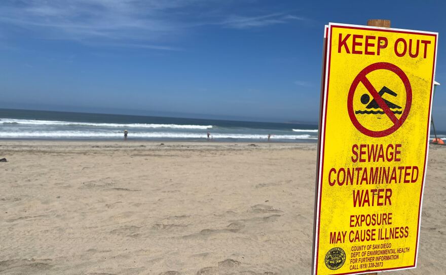 County of San Diego's Department of Environmental Health beach closure sign posted on Imperial Beach in Imperial Beach, Calif. on Aug. 4, 2022.<br/>