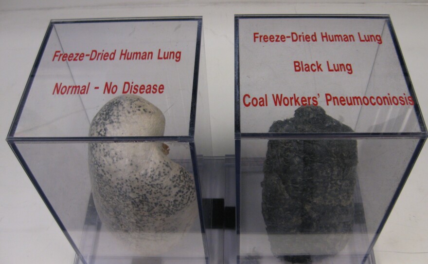 Excised and preserved lungs on display at the National Institute for Occupational Safety and Health in Morgantown, W.Va., in 2012, show the dramatic effect of black lung disease.