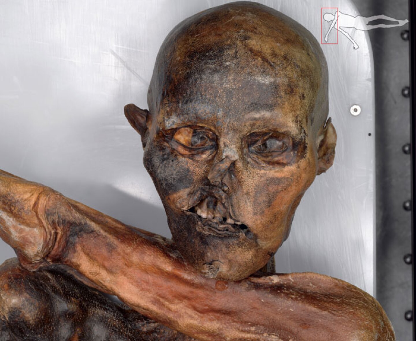 The face of the 5300-year-old Iceman mummy.