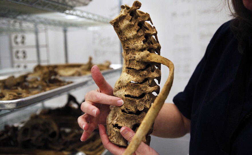 Experts can piece together life stories from a person's bones.