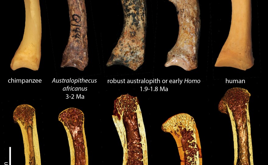 (Top row) First metacarpals of the thumb in (from left to right) a chimpanzee, fossil hominins Australopithecus africanus, and two specimens belonging to either a robust australopith or early Homo, and a human. The bottom row shows 3D renderings from the microCT scans of the same specimens, showing a cross-section of the spongy trabecular bone inside.