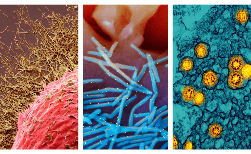 From left: 1) Colored scanning electron micrograph (SEM) of a human cell infected with H3N2 flu virus (gold filamentous particles). 2) Scanning electron micrograph of human respiratory syncytial virus (RSV) virions (colorized blue) that are shedding from the surface of human lung epithelial cells. 3) Transmission electron micrograph of SARS-CoV-2 Omicron virus particles (gold).