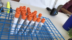 Vials of coronavirus test samples at the University of San Diego testing site on July 15, 2020.