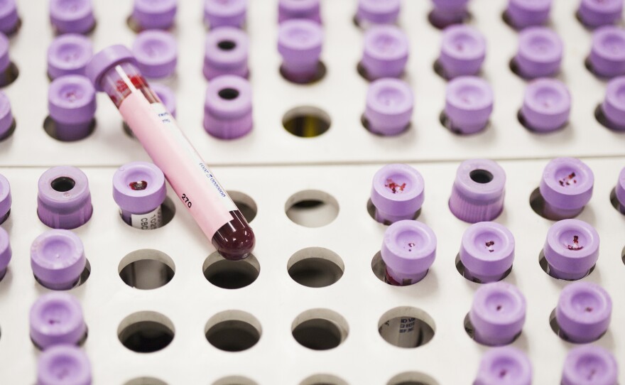 Researchers have identified waves of proteins in blood that peak at three distinct stages of life. What do the findings mean for aging?