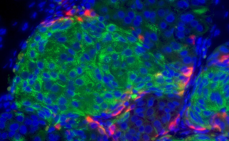 Harvard scientists made insulin-producing beta cells from human stem cells. After transplantation into mice with diabetes, the lab-made beta cells produced enough insulin to cure the animals.