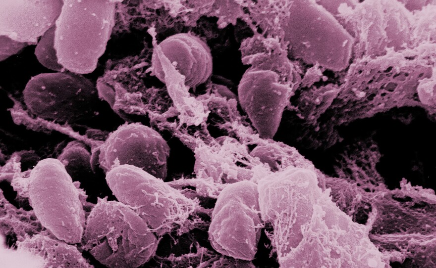 Rod-shaped specimens of Yersinia pestis, the bacterial cause of plague, find a happy home here in the foregut of a flea. Fleas can transmit the infection to animals and people, who can get pneumonic plague and transmit the infection through a cough.