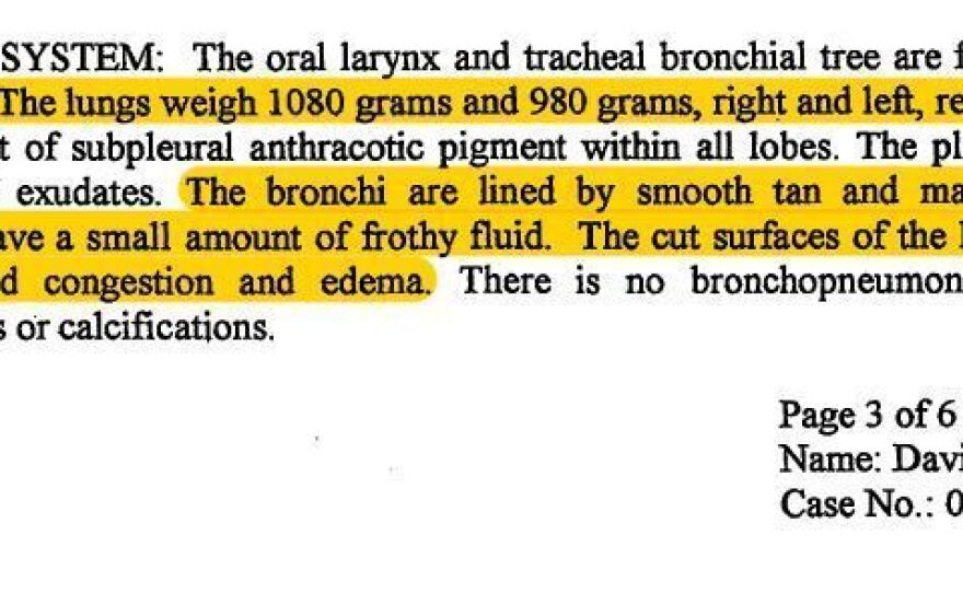 David Hocker was executed in Alabama in 2004. His autopsy — a section of the report is shown here — showed significant pulmonary edema and lungs that were nearly twice as heavy as would be expected. NPR reviewed more than 200 inmate autopsies and found similar results in 84% of the cases.