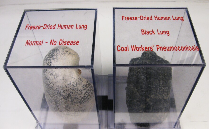 A display case at NIOSH shows a normal lung and a diseased black lung from inhaling coal dust and other harmful particles while coal mining.