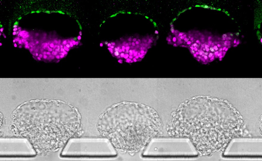 These human embryo-like structures (top) were synthesized from human stem cells; they've been stained to illustrate different cell types. Images (bottom) of the "embryoids" in the new device that was invented to make them.