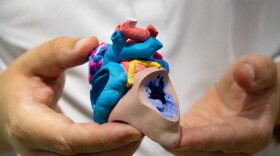 Justin Ryan holds a patients heart model. The heart has a hole in it, a common birth defect. These models are used in surgical planning. 