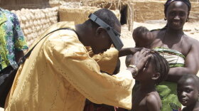 In a remote village of Niger, a doctor checks the eyes of children for signs of the blinding disease trachoma.