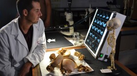 A laboratory study of 49,000 year-old Neanderthal bones discovered in El Sidrón, a remote, mountainous region of northern Spain.