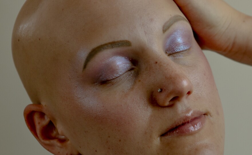 "I don't want people treating me differently just because I have alopecia. I'm healthy. I can do everything you can do. I just don't have hair." Jenny Jobson