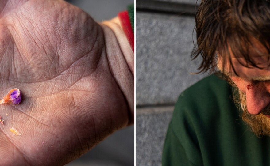 Neil, we're not using his full name because of his illegal drug use, is homeless and living in the city's Tenderloin district. He says he smokes the powerful opioid fentanyl to deal with depression and chronic stomach pain.