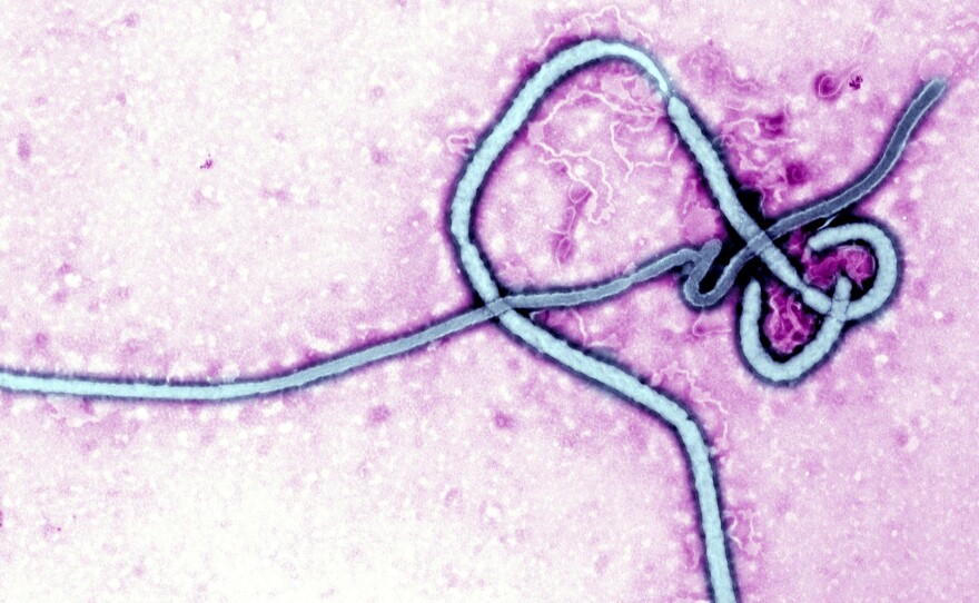 Ebola Virus, Transmission Electron Micrograph Of The Ebola Virus, Rna Virus, Cause Of Hemorrhagic Fever.