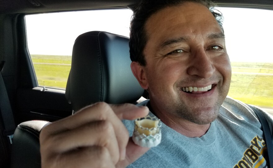 Michael Vigil, an oil contractor from Douglas, Wyo., traveled 250 miles to Denver to have his aortic valve replaced in May. He said he would have preferred his local hospital do the procedure.