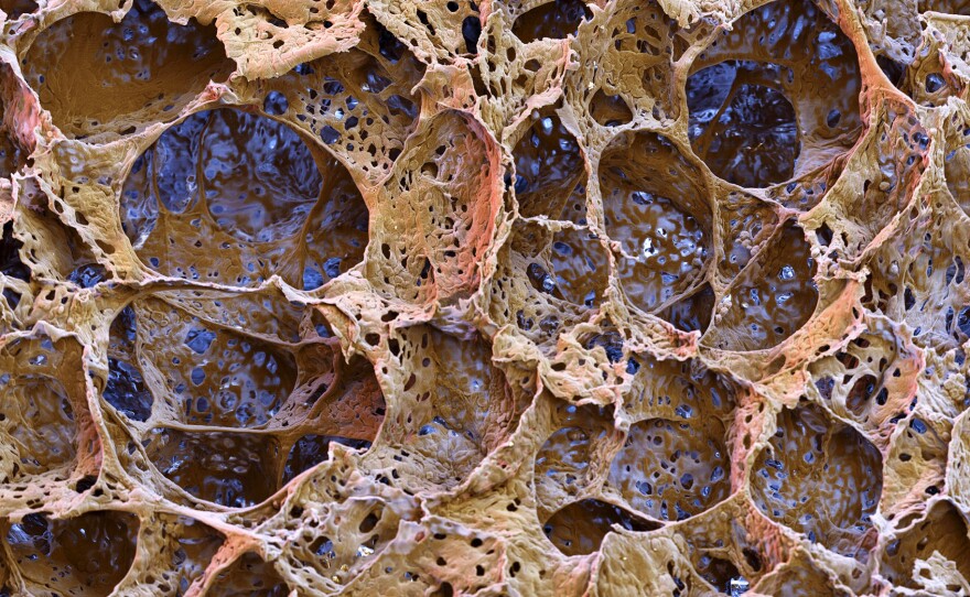 The tiny sacs in the lungs, called alveoli, move oxygen into the blood and carbon dioxide out.