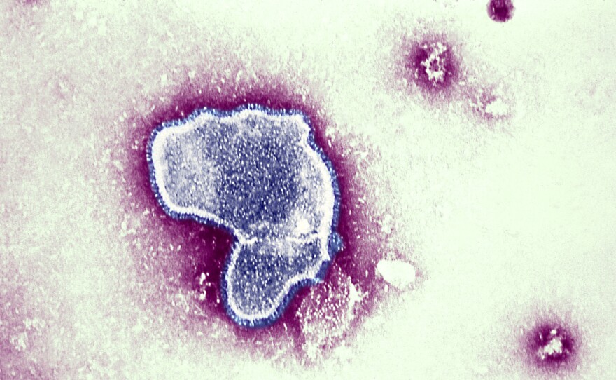 At the moment there is little data available on the impact of contracting COVID-19 and the respiratory syncytial virus (pictured), and whether together they can make a person sicker. But health officials worry it could put young patients — who are not eligible for the coronavirus vaccine — at greater risk.