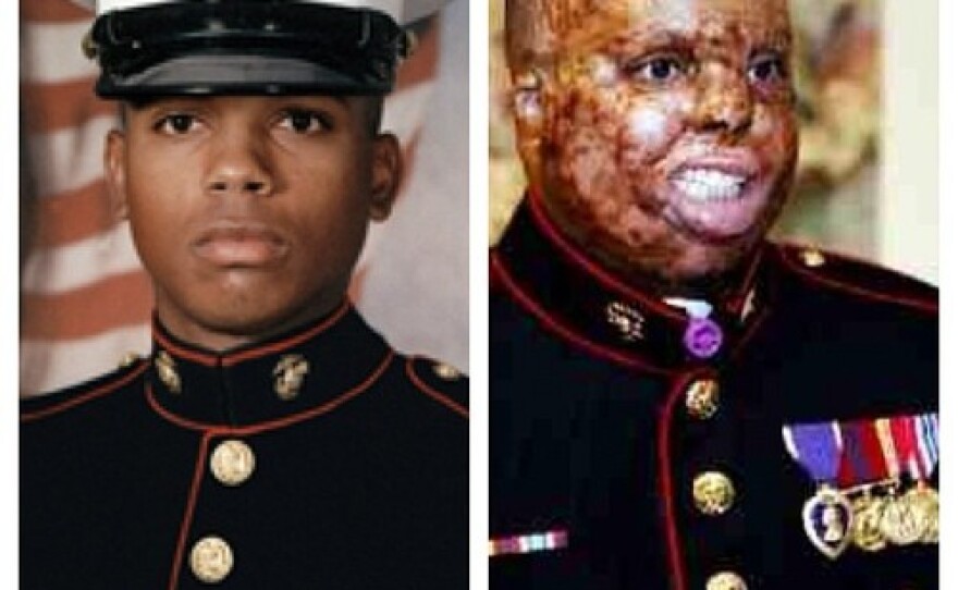 Sgt. Merlin German before and after his injury.