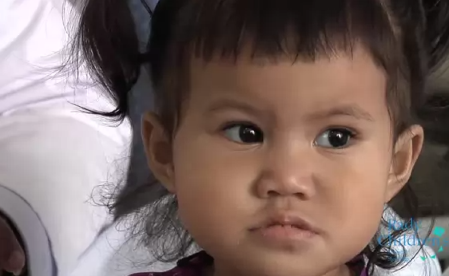 Pictured is 17-month-old Jahaziel Faualo who received a heart transplant at Rady Children's Hospital on Jan. 31, 2015.