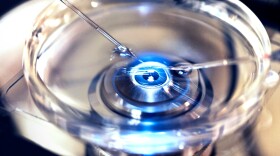 The creation of eggs from skin cells and genetic screening of embryos  could transform in vitro fertilization for the masses.