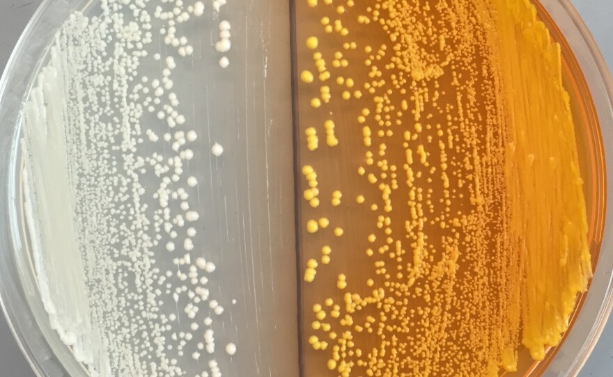 Scientists inserted an orange pigment into yeasts, right, to help find the missing enzyme needed to complete the synthesis of morphine in the microorganism.